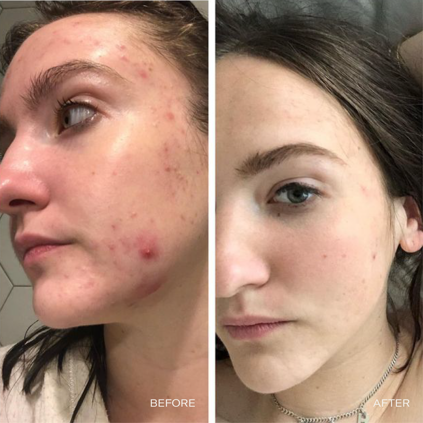 Cleanse - Facial Cleanser