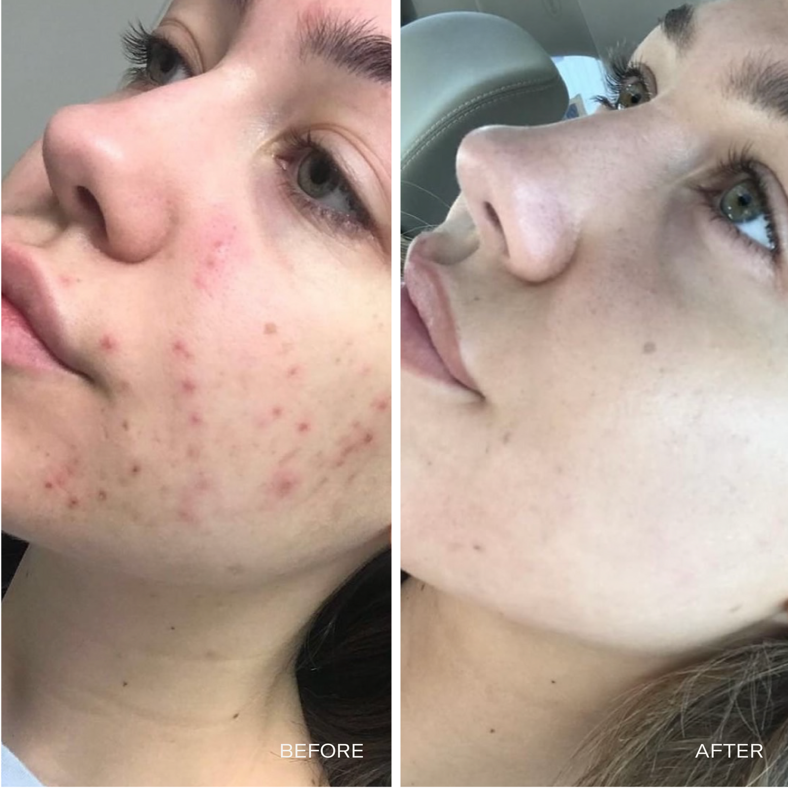 Skin Oil-Cleansing Starter Kit - Facial Cleanser