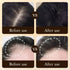 Biotin fast Hair Growth oil Products Care Scalp Massage Treatments Anti Hair Loss Effective Grow Thicker Hair serum for men