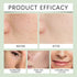 HOYGI Hyaluronic Acid Cleanser Anti Acne Oil Control Blackhead Remover Skin Cleansing Gel Brightening Pore Cleaning Face Wash