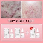 Collagen Peptide Facial Serum Targets Dull Skin Boosts Skin Elasticity Stimulates Skin Renewal Repair Salmon PDRN KOREAN Product