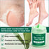 YURHERSU Foot Care for Dry, Cracked Heels, Knees and Hands with Moisturizer to Remove Dead Skin