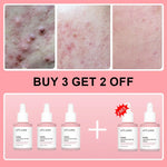 Collagen Peptide Facial Serum Targets Dull Skin Boosts Skin Elasticity Stimulates Skin Renewal Repair Salmon PDRN KOREAN Product